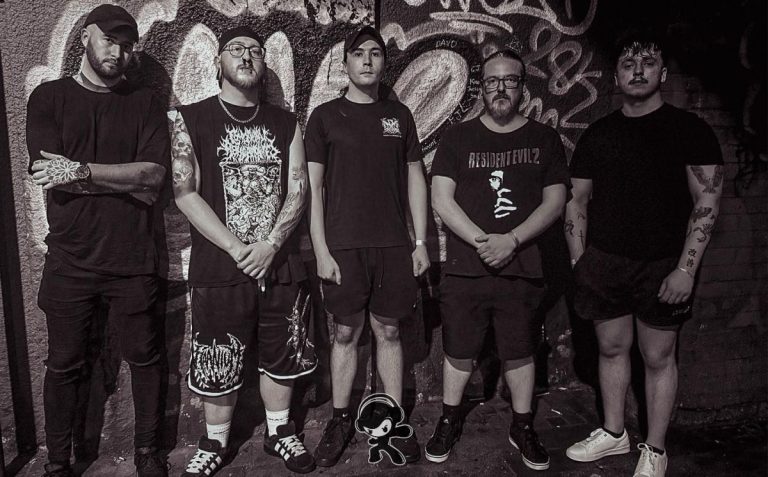 Congenital Abnormalities - Pathological Execution (Death Metal)